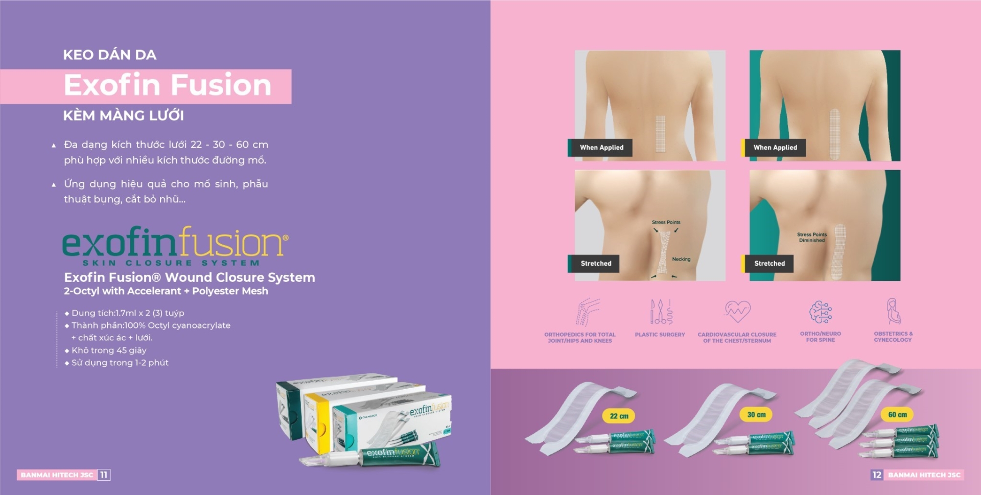 Keo dán da Exofin Fusion kèm màng lưới